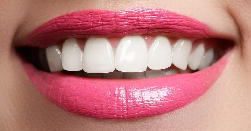 Dental Check-Up Dubai