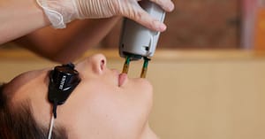 Laser Hair Removal Sessions