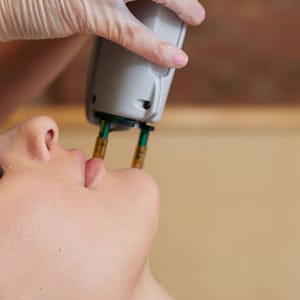 Laser Hair Removal Sessions