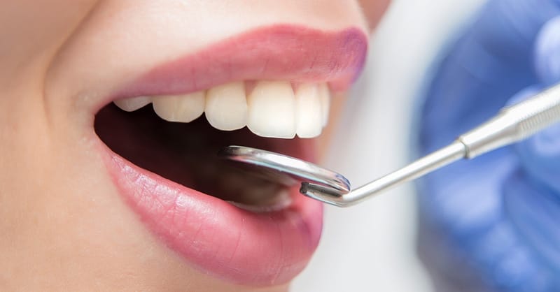 Choice Of Dental Treatment At Saphire Dent Dubai Dubai - Image 2