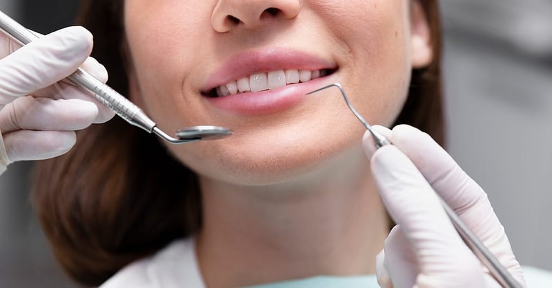 Choice Of Dental Treatment At Saphire Dent Dubai Dubai - Image 4