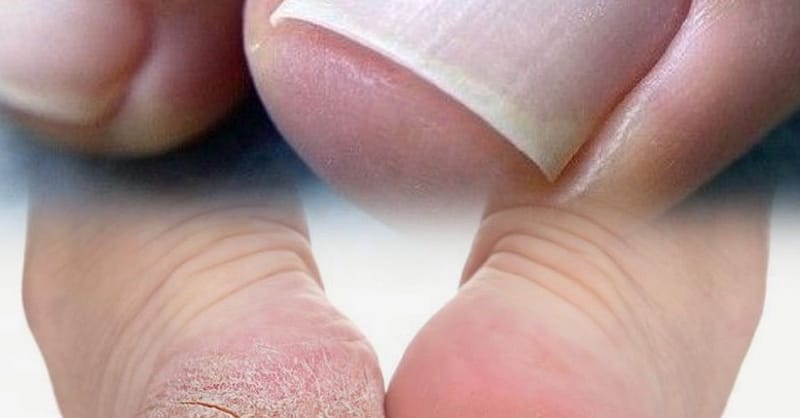 Mani-Pedi Session For A Fresh Look! Dubai - Image 3